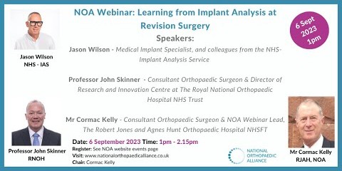 Learning from Implant Analysis webinar recording